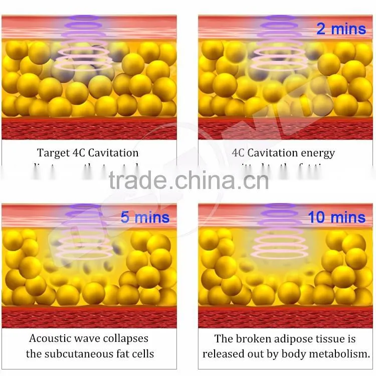 Vacuum Roller Massage Radio Frequency Ultrasonic Cavitation Remove Localized Fat Or Deep Cellulite