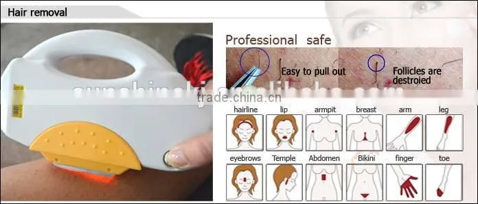 Strong power 2000w portable elight hair removal machine home photofacial machine