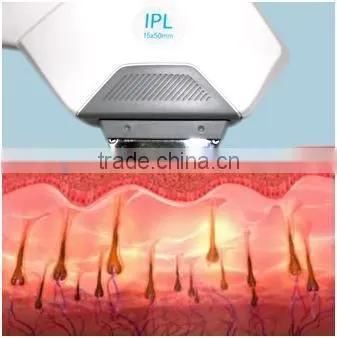 Apolomed Supper price home use ipl laser permanent hair removal machine for facial care