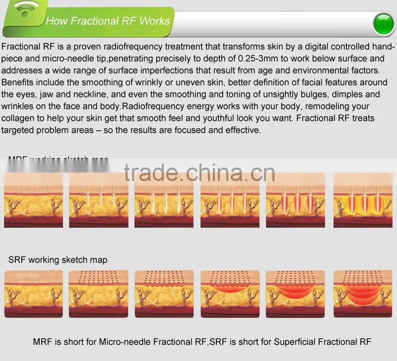 Fractional rf microneedle, cooling handpiece and RF handpiece, multiple treatment tips