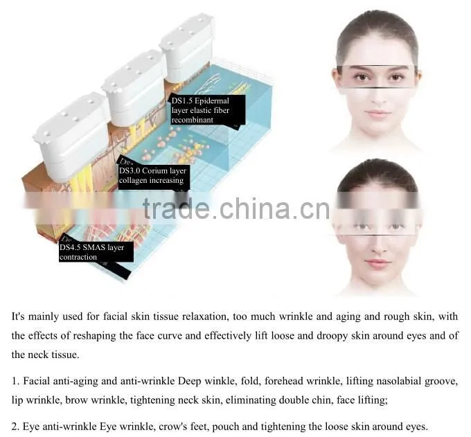 face lifting china beauty spa equipment / hifu beauty salon equipment