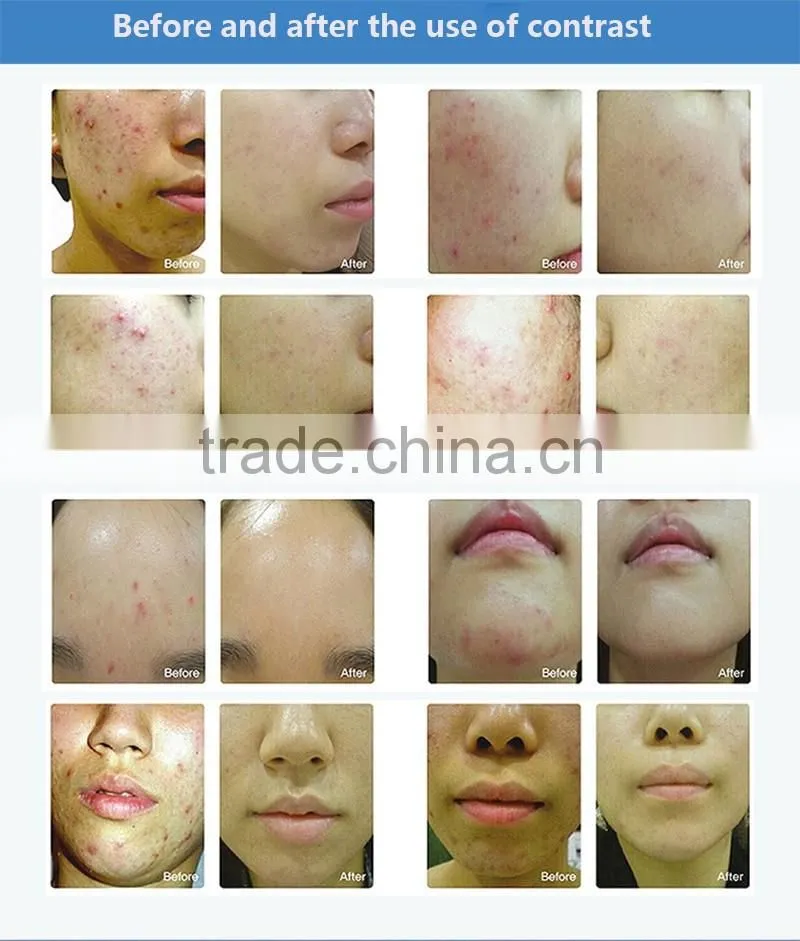 2017 New 4 Color LED Facial Mask Photon Skin Care Beauty Machine SPA PDT Therapy Skin Rejuvenation Acne Remover Anti-wrinkle