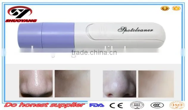 Alibaba Hot Sale cheap Blackhead Remover