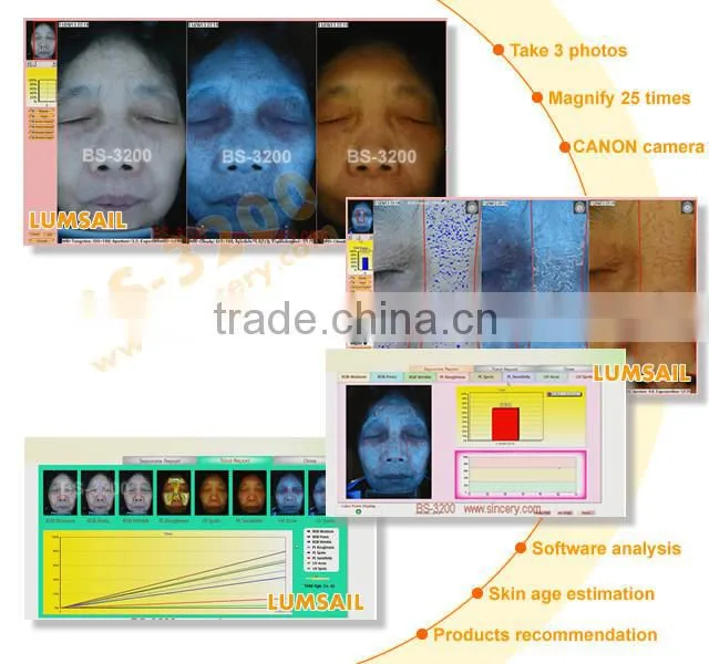 2016 portable newest 3d facial skin and hair analyzer magnifier machine