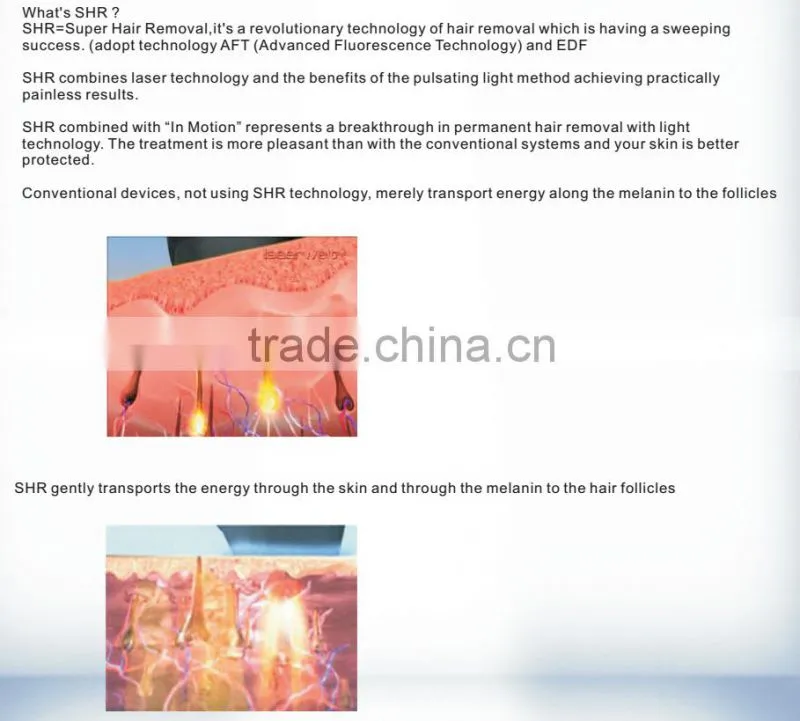 SHR IPL laser hair removal