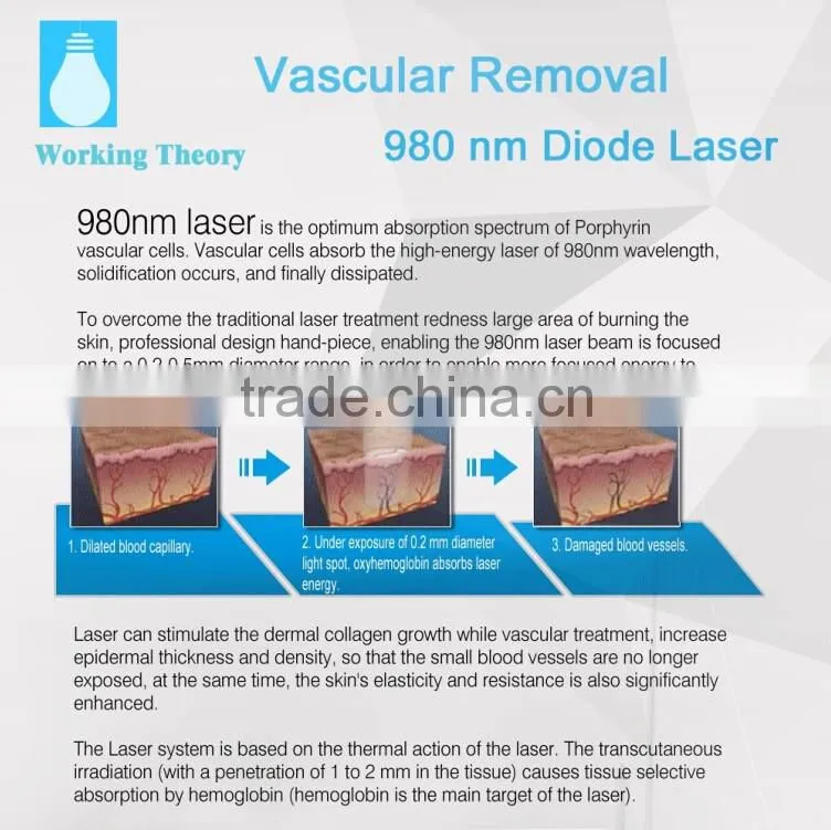 Vascular Removal Spider Vein removal 980nm medical diode laser 16W