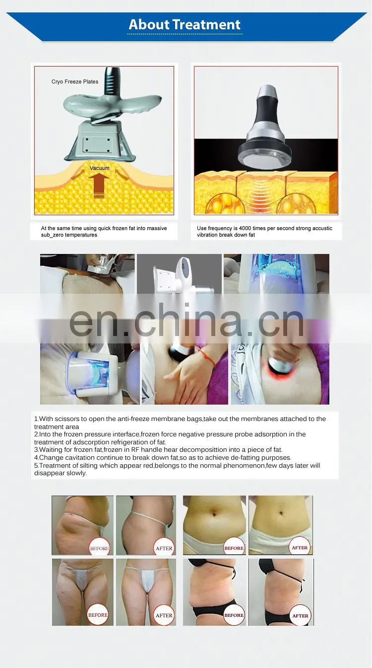 2019 Portable celulite remover and vacuum machine body slimming and double chin removal