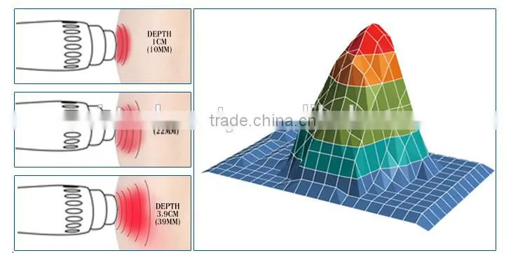 Hot selling shockwave therapy for body pain ultrasonic wave