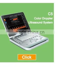 Sonostar new 3D 4D laptop ultrasound scanner ipad ultrasound scanner for sale BProbe-2