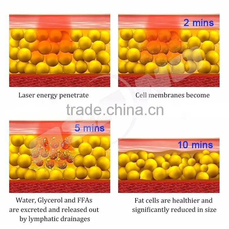 Low Level I Lipo Laser Slimming Machine