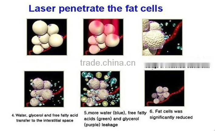 home use !!! Lipo laser Slimming Machines slim beauty equipment