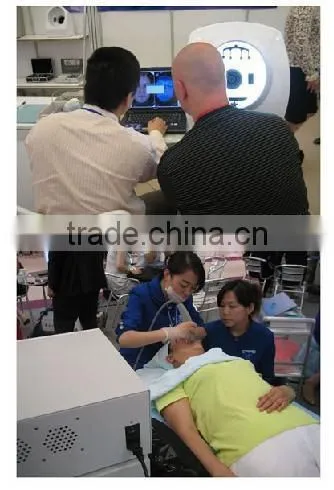 Hot selling fractional co2 laser for scar removal