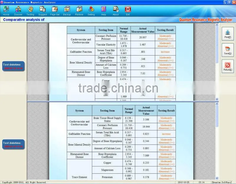 Factory price 3.9.6 version mini quantum resonance magnetic analyzer