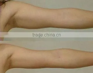 best cellulite!! super vacuum body slimming machine F019