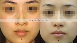 2013 super mini IPL hair removal machine