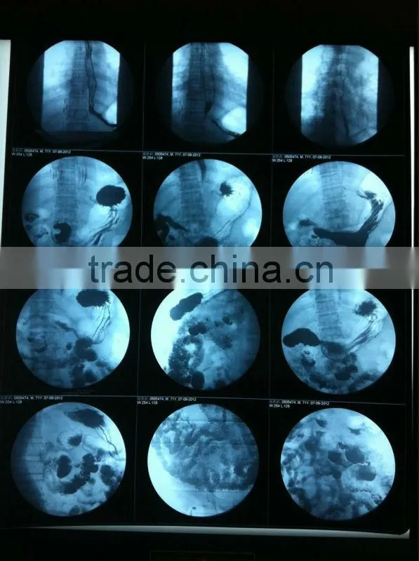 high quality low price of paper film of size A3.A4 for color Doppler ultrasound machine