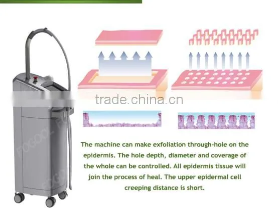 1540nm erbium glass fractional laser/ 1550nm erbium glass fiber laser fogool beijing