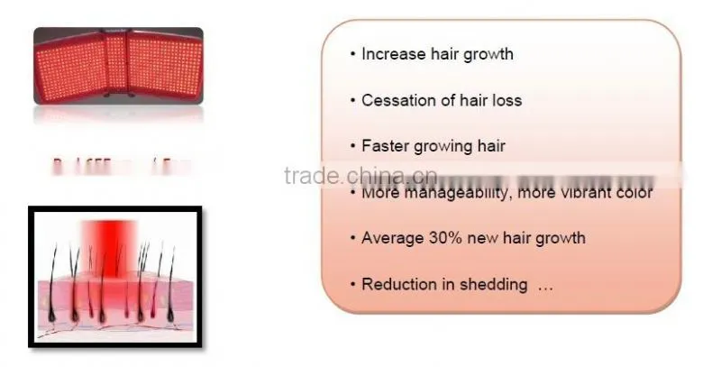 PDT laser hair growth /best hair loss treatment machine