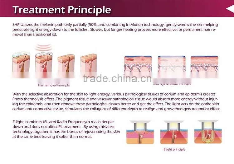 Professional 2016 newest Minimalism HR SR two probe stainless head ipl hair removal machine