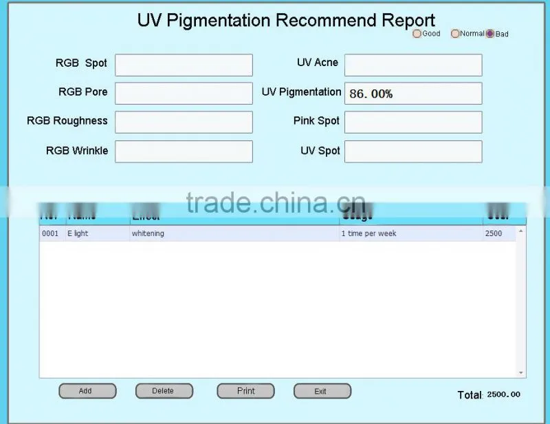 2016 Newest Portable Skin analysis machine Skin analyzer with CE