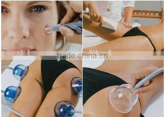 4*double suction cup vacuum and cavitation slimming machine