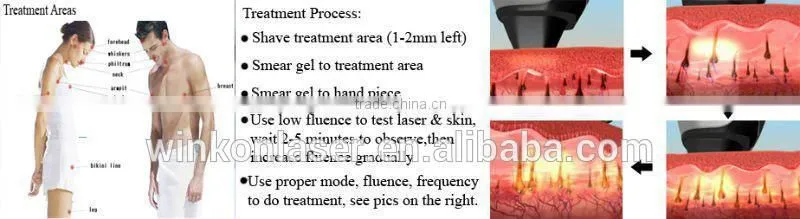 Long pulse nd yag 1064 nm hair removal laser for kinds of color