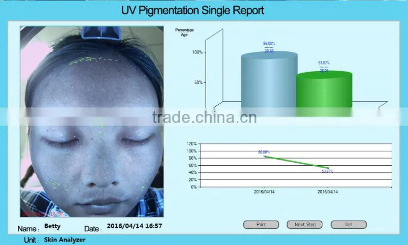 Langdy facial skin analysis machine magic mirror skin analyzer factory direct selling price with CE