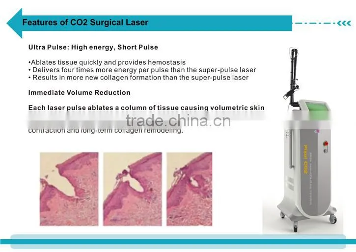 Portable CO2 Laser Fractional Pixel Vaginal Laser Tightening
