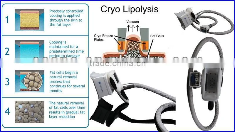 promotional cryo body sculpting machine with vacuum therapy roller