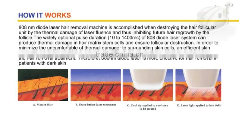 808nm diode laser hair removal machine/laser 808nm/ Permanent Hair Removal Machine