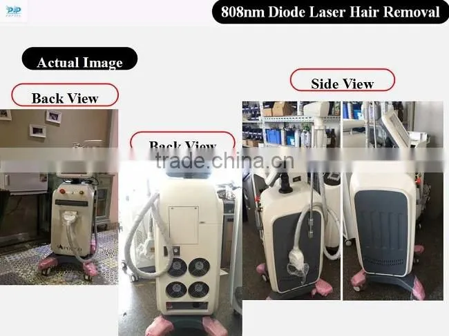 DLP7 808 diode Laser hair removal machine diode POP- DL7 808nm diode laser machine for POPIPL