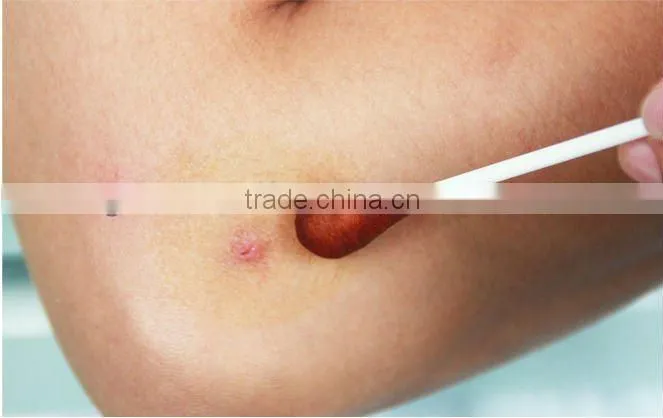 Povidone-iodine swabstick