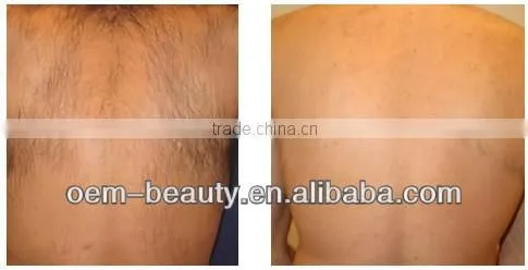 Portable IPL hair removal beauty device A003
