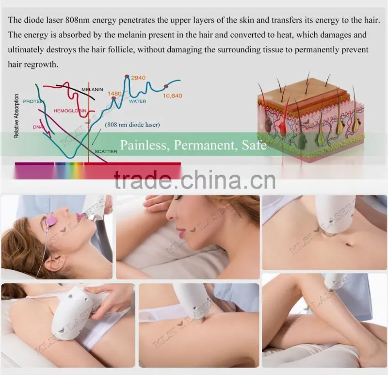 Medical laser spa use 808 diode permanent depilazione group equipment