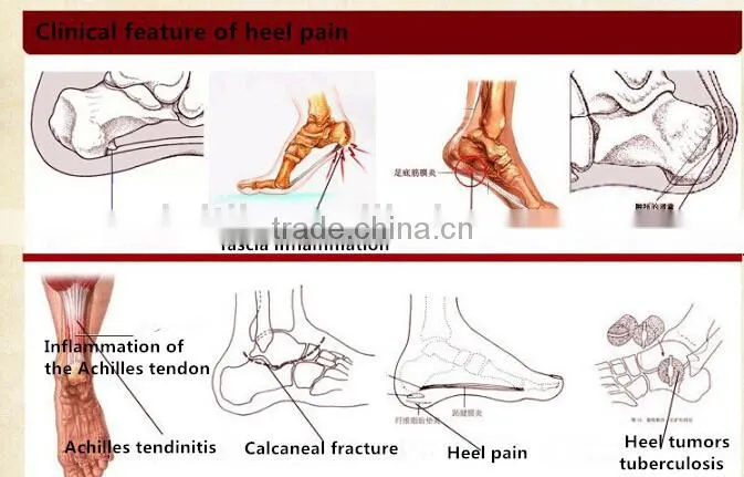 HDT healthcare products Heel pain,spur pain patch,pain relief patch