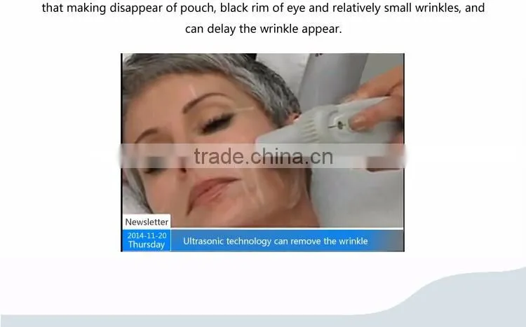 2016Fashion smartsonic hifu ultrasound for skin lifting