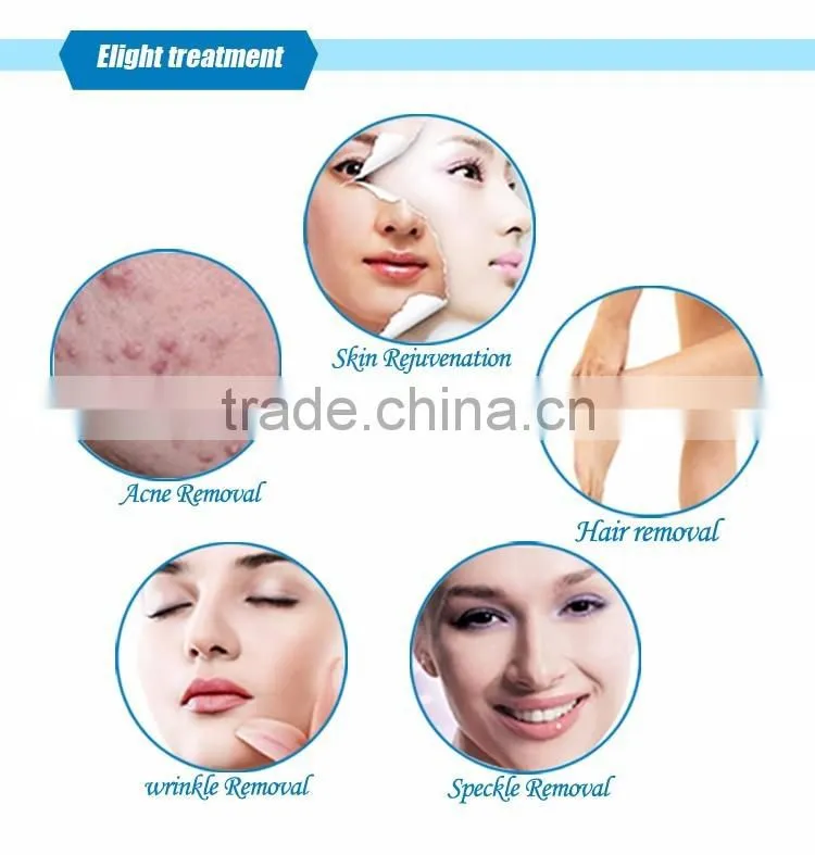 CE approved imported lamp 2 IN 1 elight IPL long pulsed nd yag laser hair removal