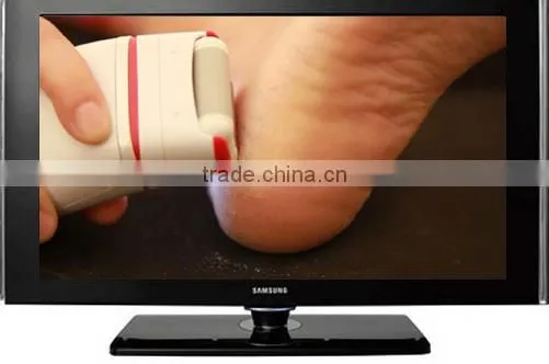 Pedicure Callus Remover Epilator Shaver