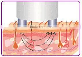 Home rf eye massager facial skin rejuvenation device for anti aging with CE PSE ROHS certificates
