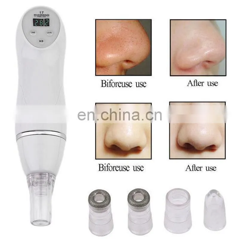Mini Blackhead remover Tool Comedo Suction Beauty Machine Physical Vacuum Facial Device