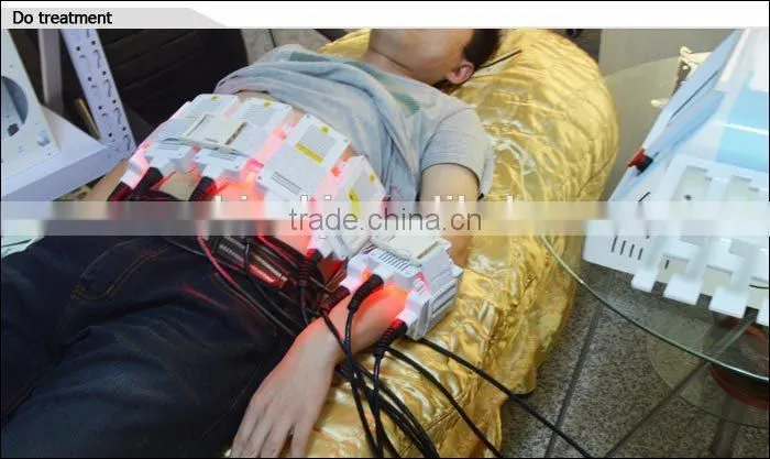 laser weight lose machine/body shaping machine/fat remover