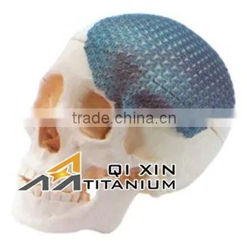 ASTM F67 F136 Customizable Titanium Mesh for Medical Implant