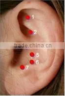 Low power fiber diode laser therapy laser for Tinnitus, Rhinitis