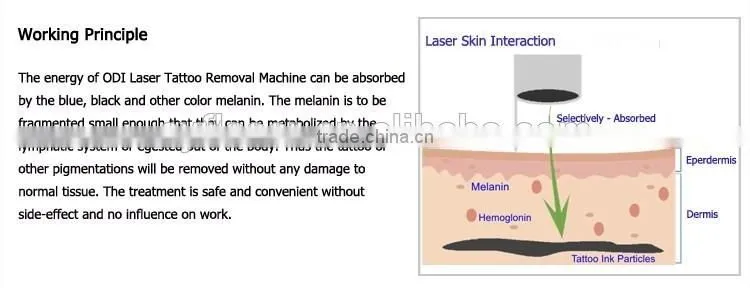 fast delivery q switched nd yag laser machine