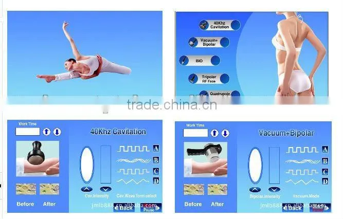 RF Vacuum Cavitation Slimming Machine