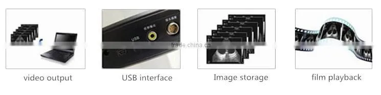 Veterinary ipad ultrasound scanner portable black and white visual pregancy test instrument