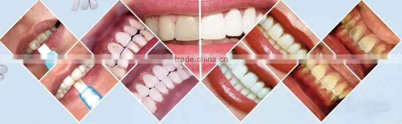Teeth Whitening,Revolutionary Teeth Cleaning Kt,No Chemicals