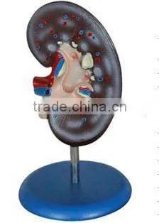 V-AM021 Kidney Model