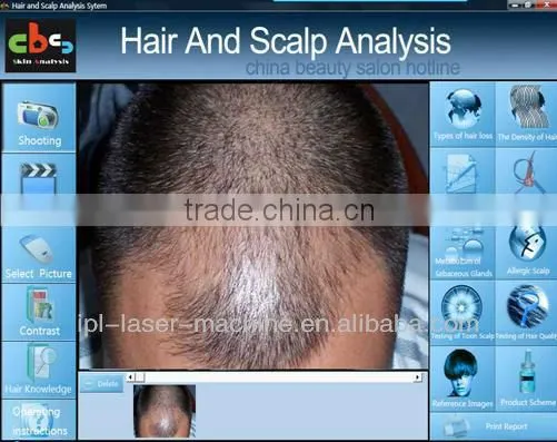 High definition hair analyzer mcahine