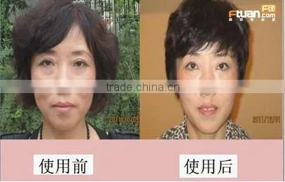Newly 4 function facial machine